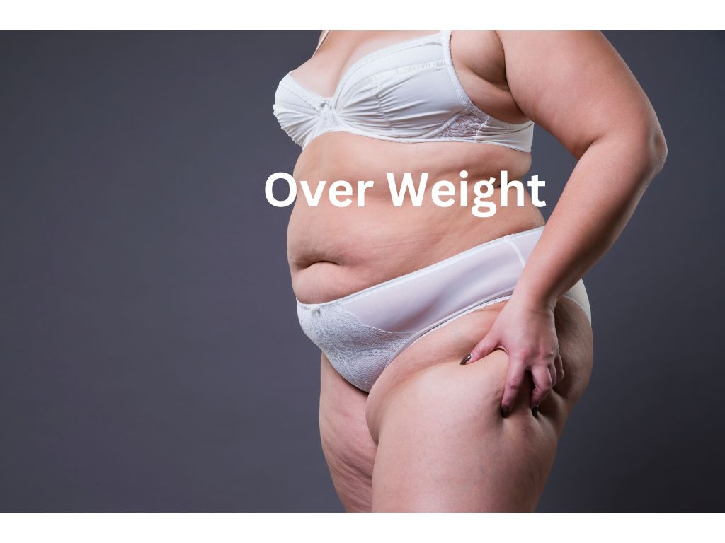 Over Weight